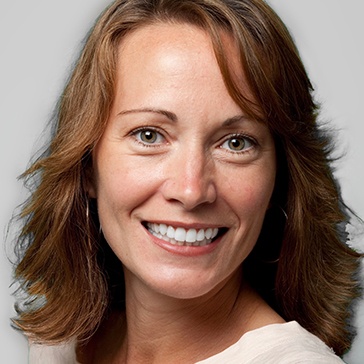 Holly after Clear Aligner Therapy