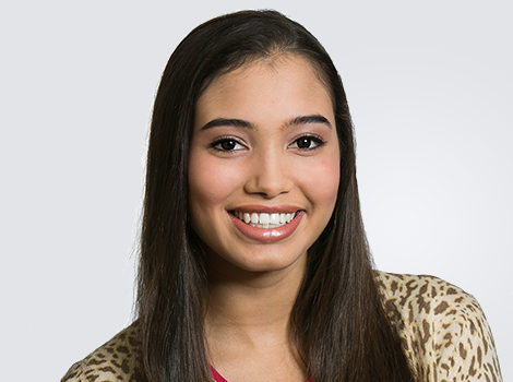 young woman smiling with dental implants in Whitinsville