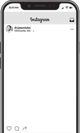 Cell phone with Instagram photo on screen for Whitinsville dentist