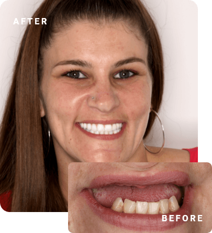 before and after