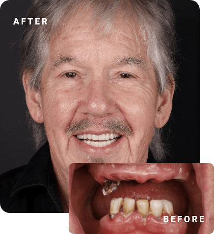 before and after