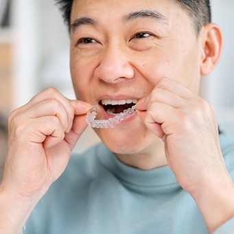 Man putting in SureSmile® aligner