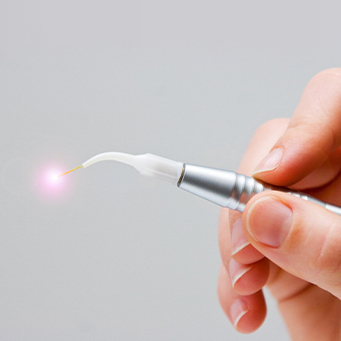 Hand holding a soft tissue laser tool