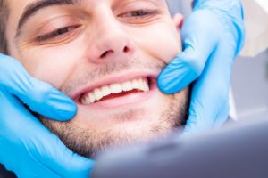 Close up of a man’s healthy smile