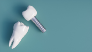 closeup of dental implants