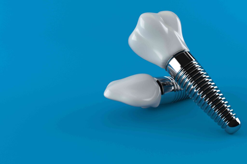 Closeup of a dental implant
